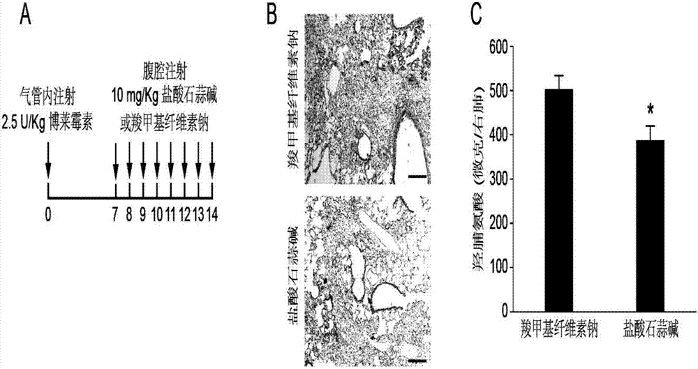 Application of lycorine hydrochloride in treatment of pulmonary fibrosis