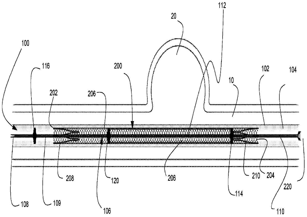 Stent delivery with expansion assisting delivery wire