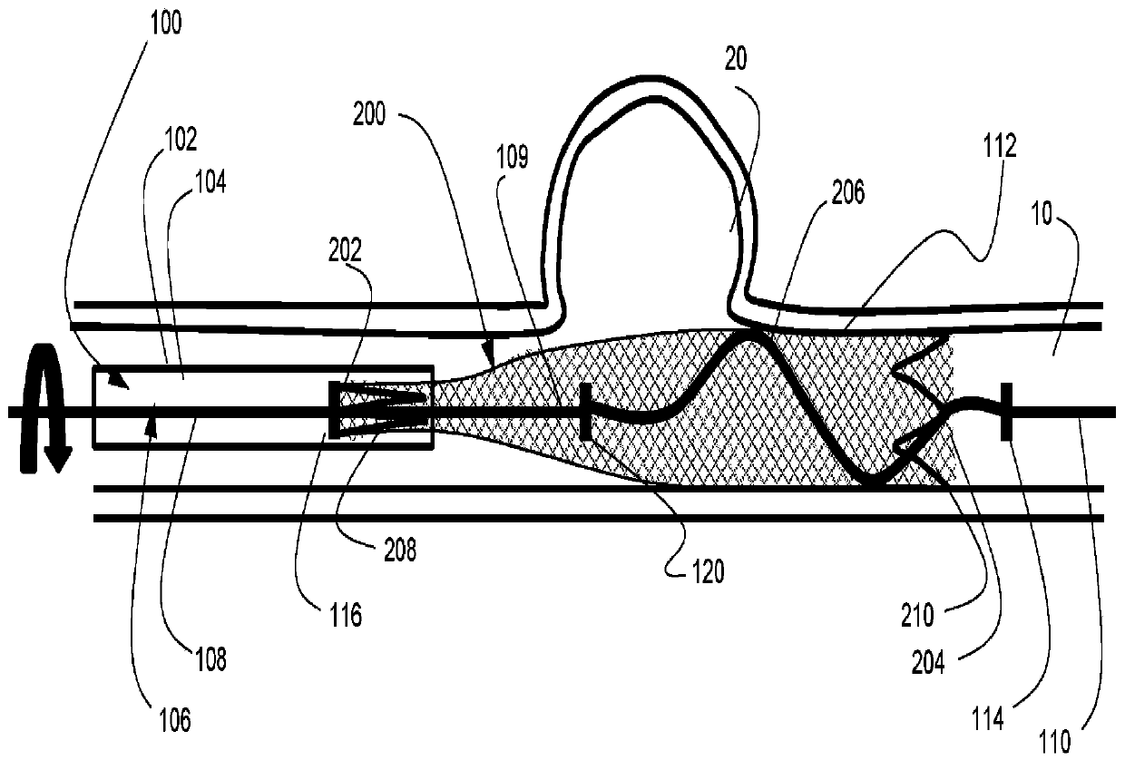 Stent delivery with expansion assisting delivery wire