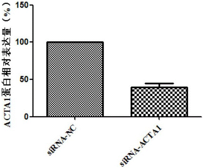 Use of ACTA1 as diagnosis and treatment marker of tongue squamous cell carcinoma