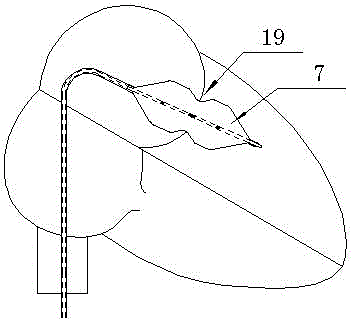 Bicuspid valve balloon dilatation catheter