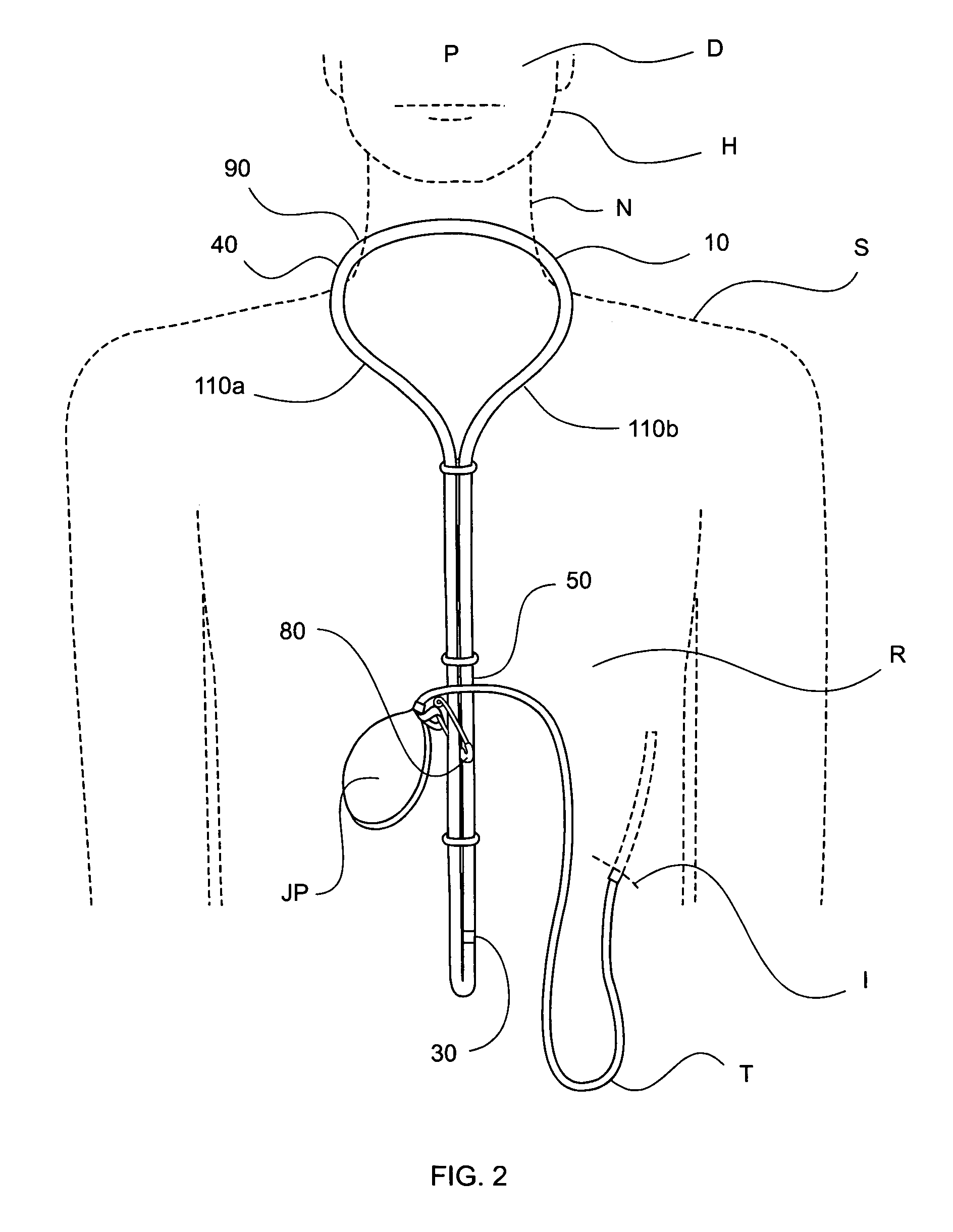 Device and method for supporting wound drainage systems