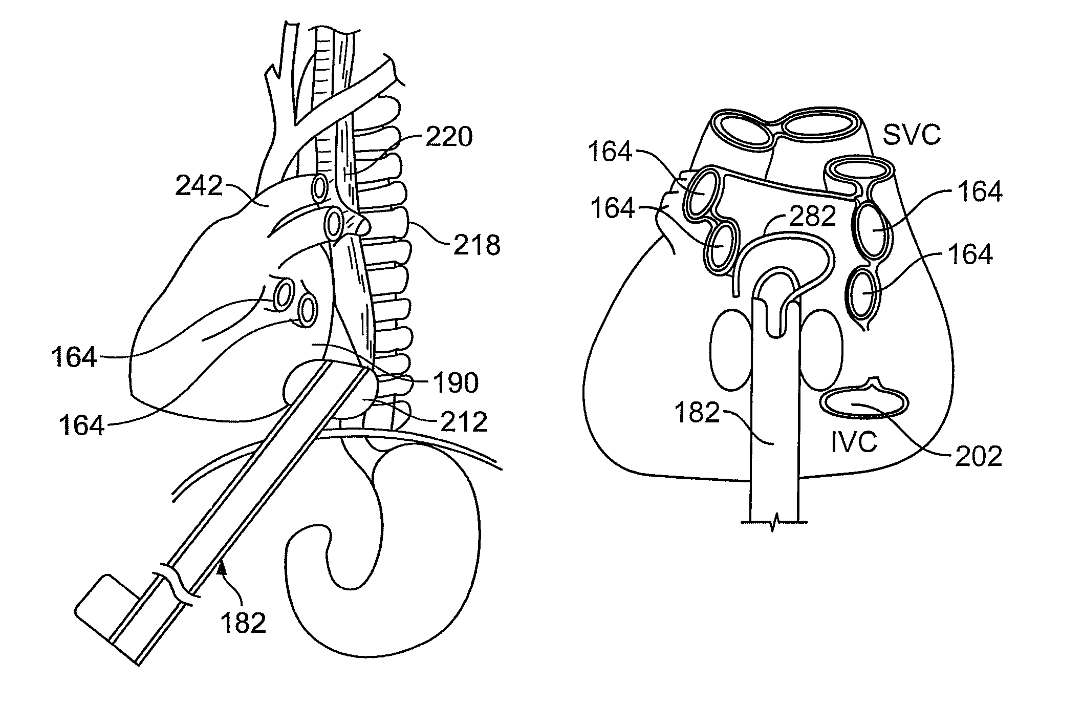 Diaphragm entry for posterior surgical access