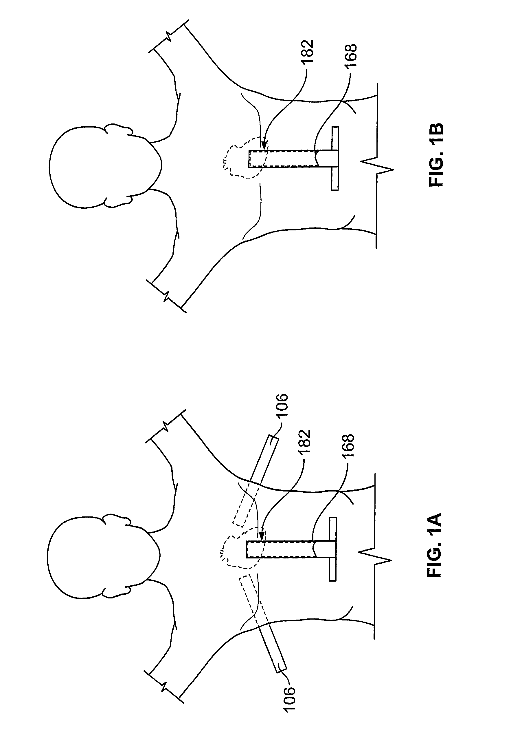 Diaphragm entry for posterior surgical access