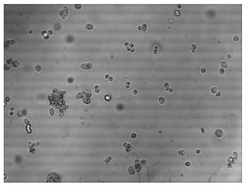 A method for preparing mink distemper antigen protein complex, antigen protein complex and application thereof