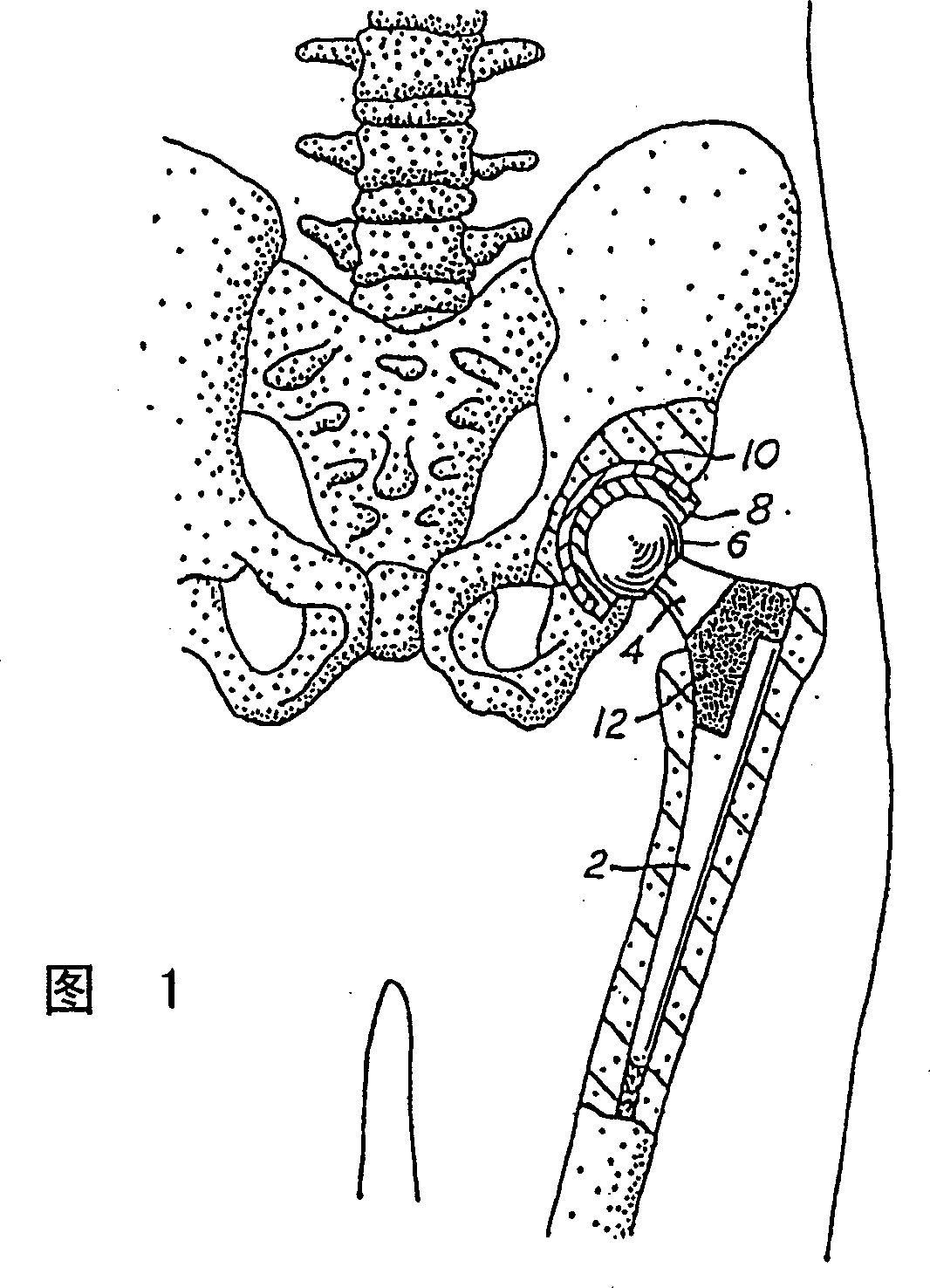 Method of surface oxidizing zirconium and zirconium alloys and resulting product