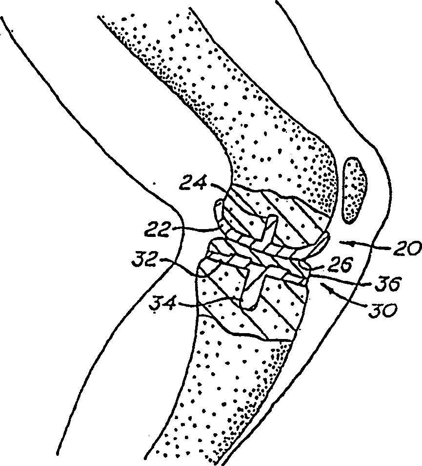 Method of surface oxidizing zirconium and zirconium alloys and resulting product