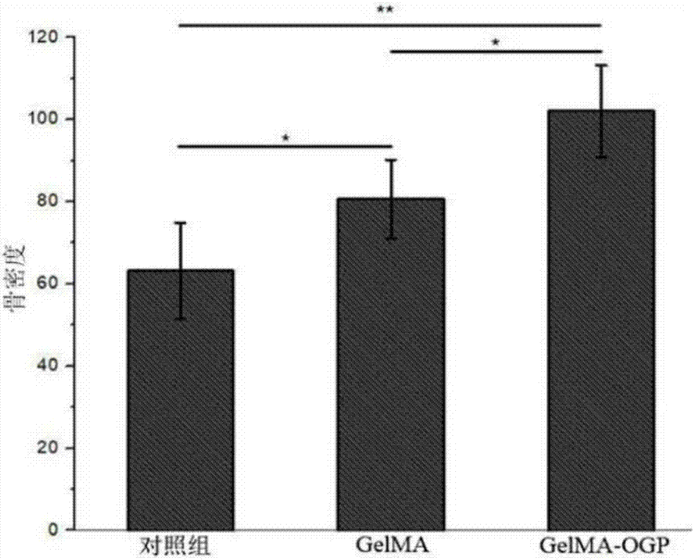 Preparation method of co-crosslinked double network hydrogel scaffold for promoting osteogenic growth