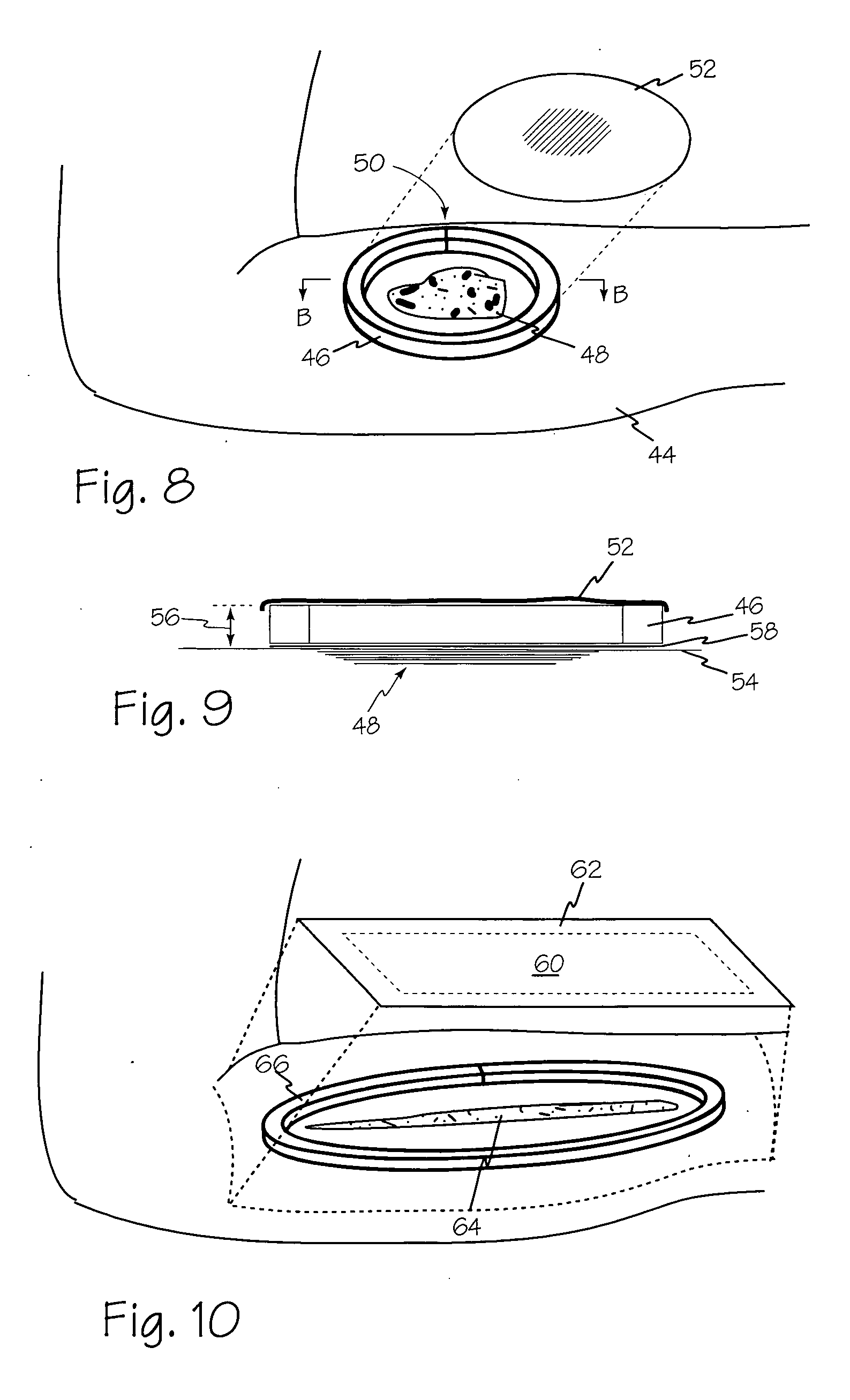 Dressing substrate