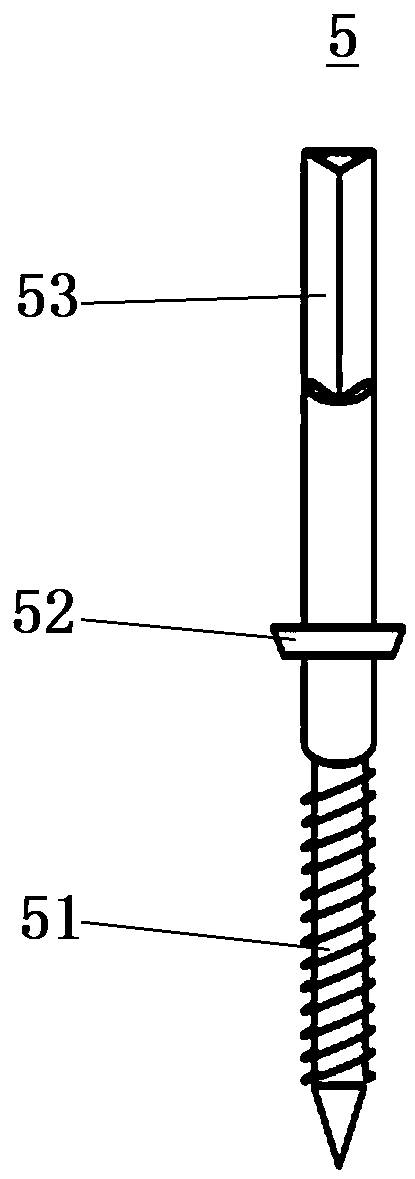 Orthopedic osteotomy board system and operation method