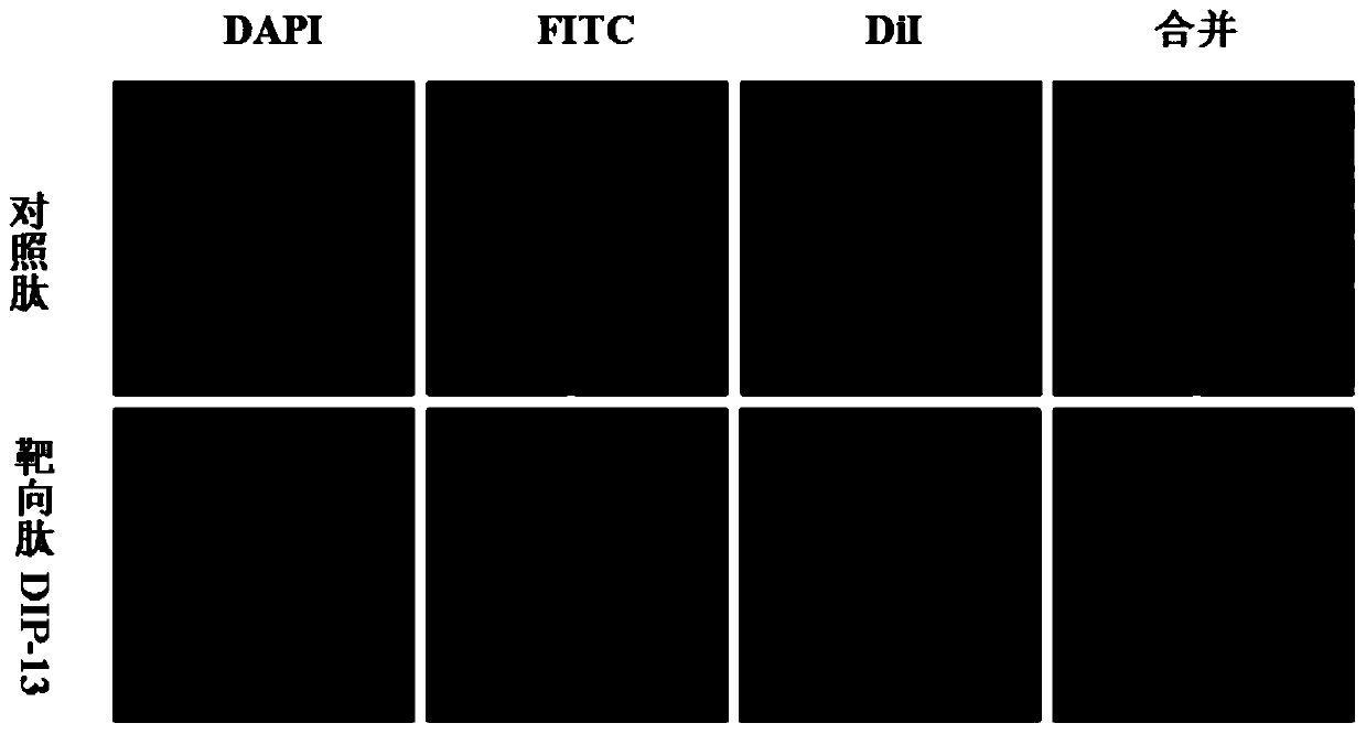 A kind of polypeptide dip-13 that can antagonize ddx3 protein RNA binding activity and its application