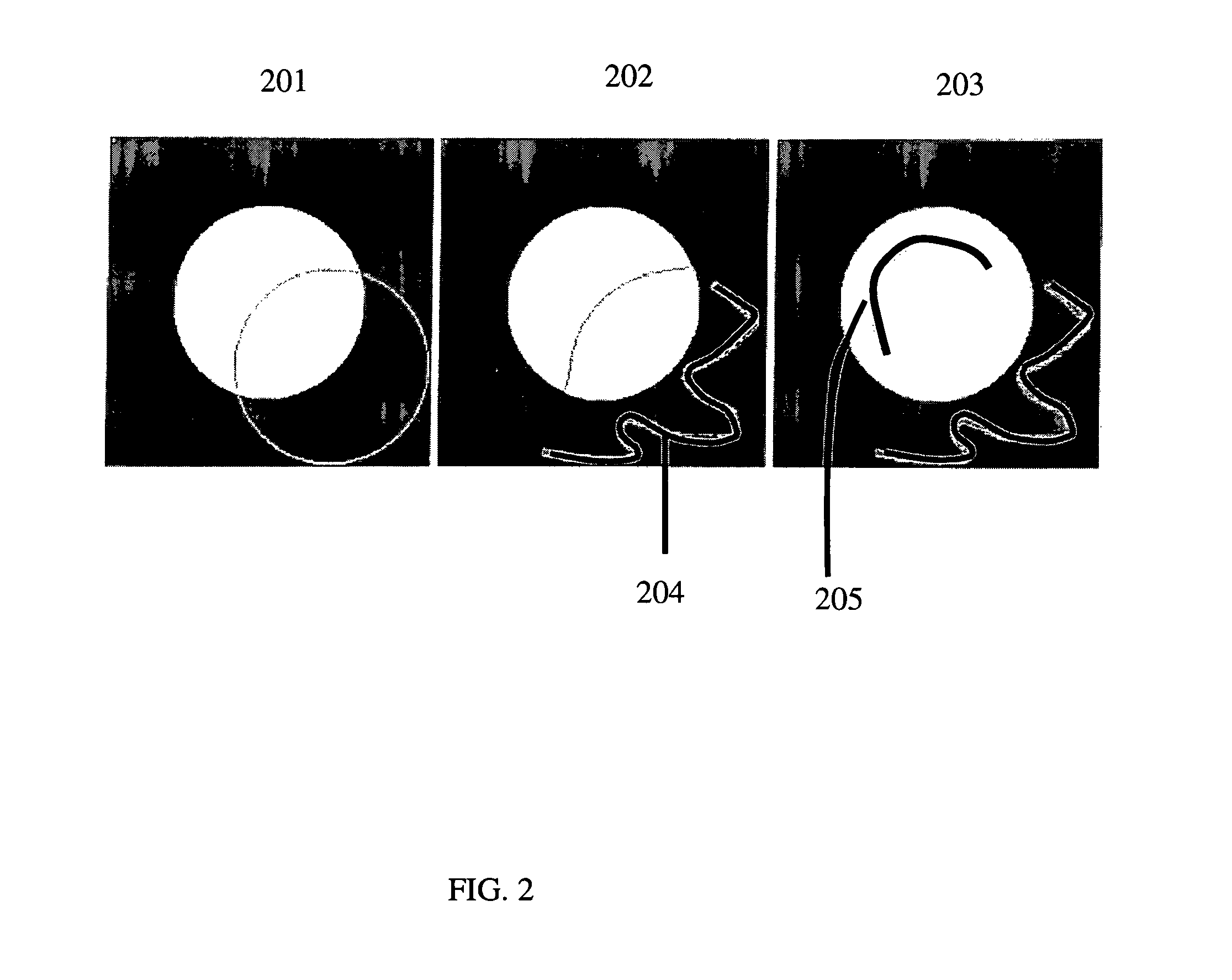 Editing of presegemented images/volumes with the multilabel random walker or graph cut segmentations