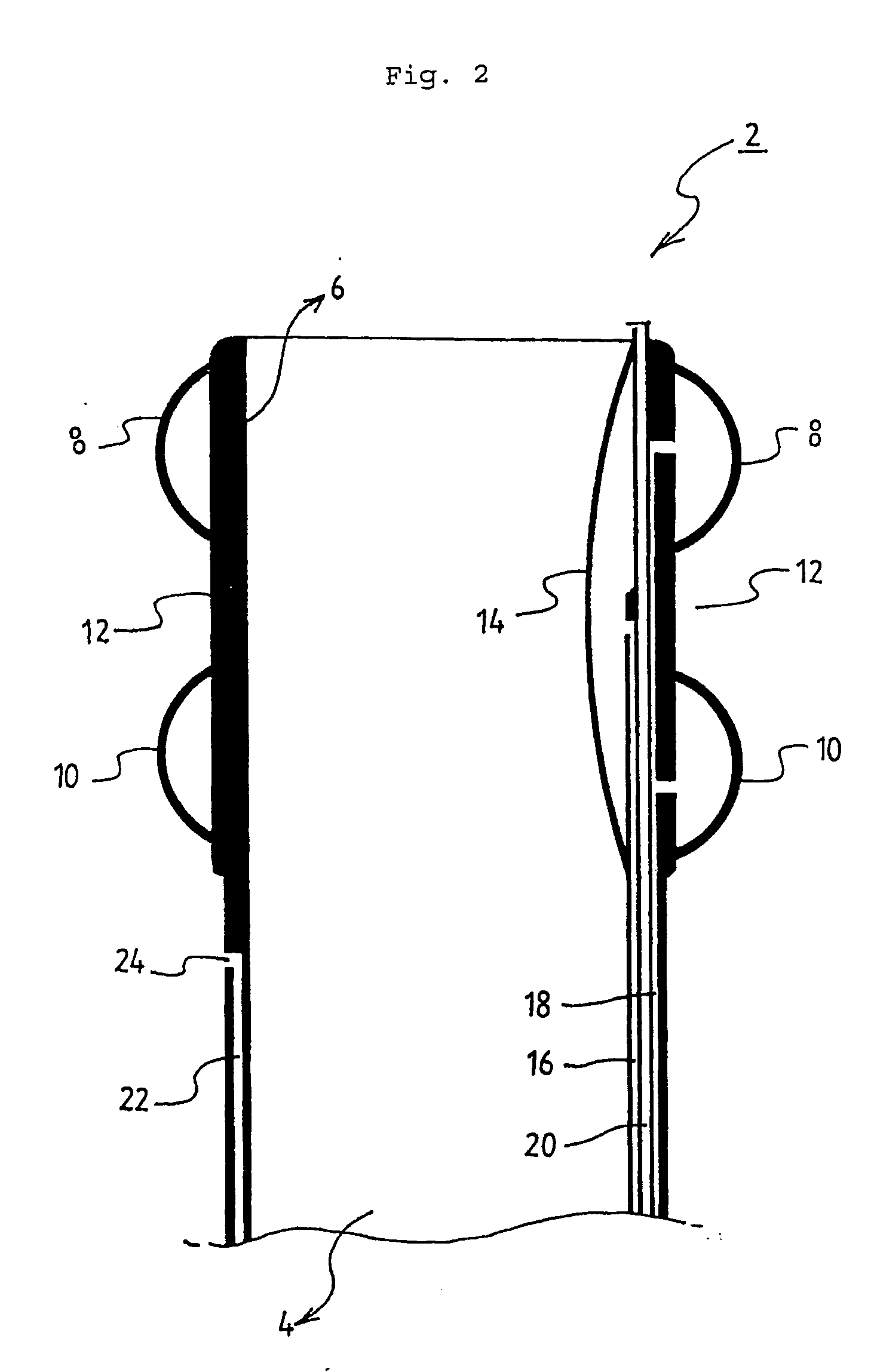 Indwelling fecal diverting device