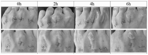 Preparation method of waterproof liquid wound dressing