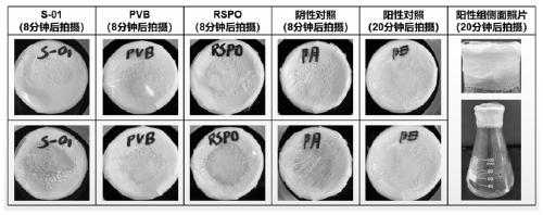 Preparation method of waterproof liquid wound dressing