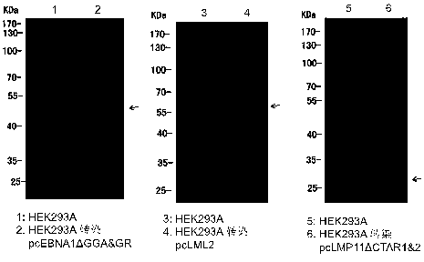 Novel synthesized molecules of EBV (Epstein-Barr Virus) consensus DNA (Deoxyribonucleic Acid) sequence and vaccine formed thereby