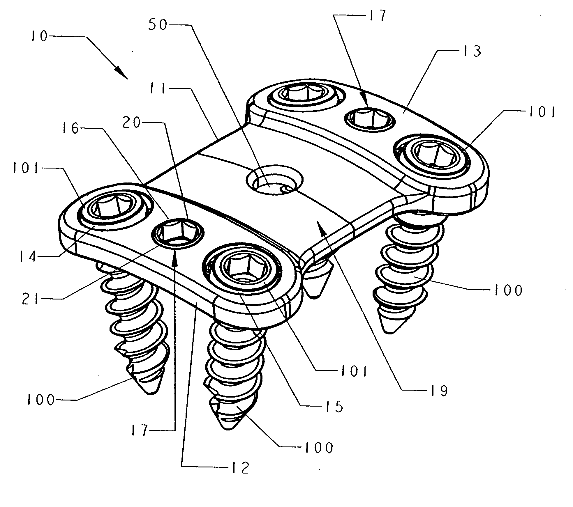 Spinal implant kit