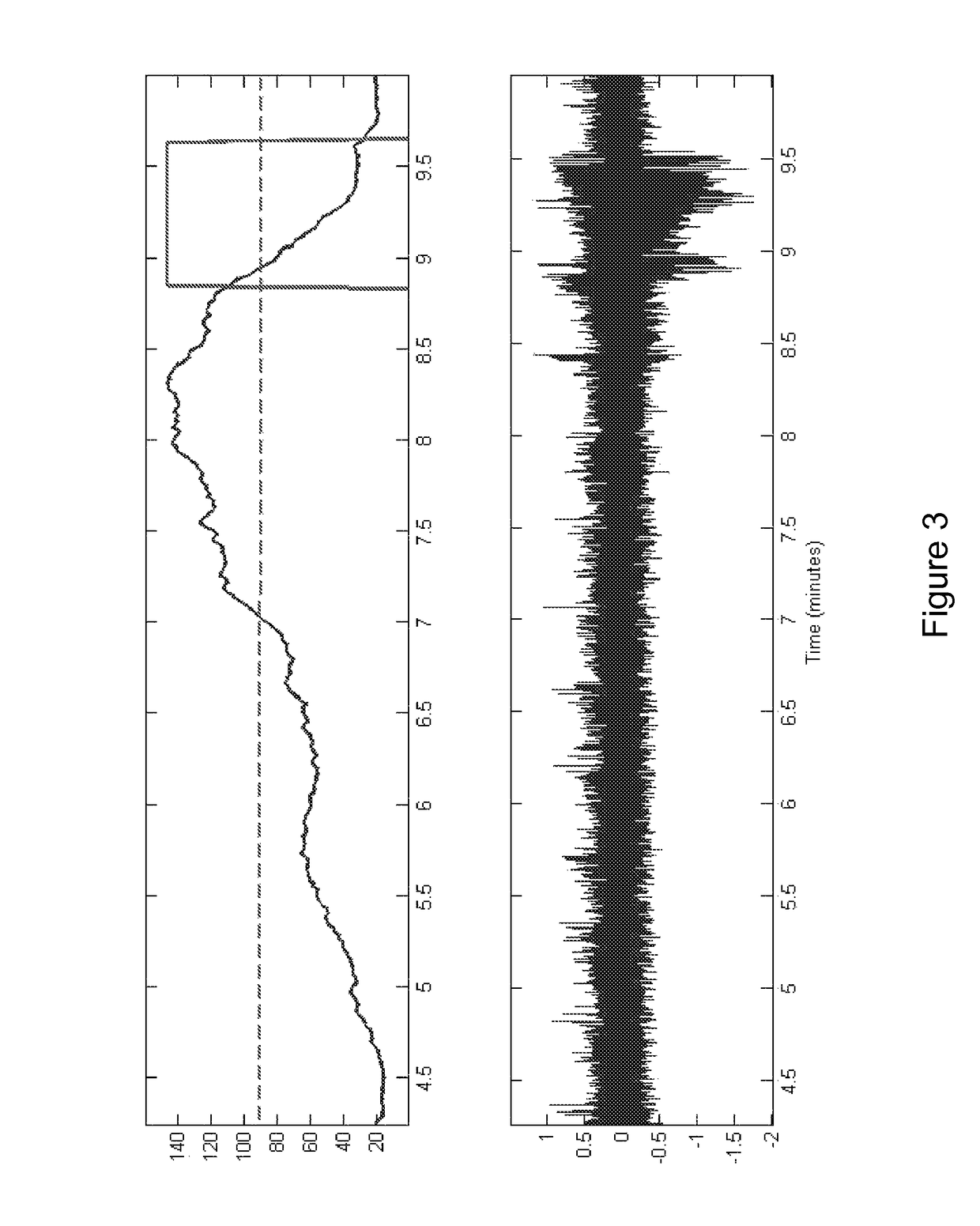 System and method of detecting and predicting seizures