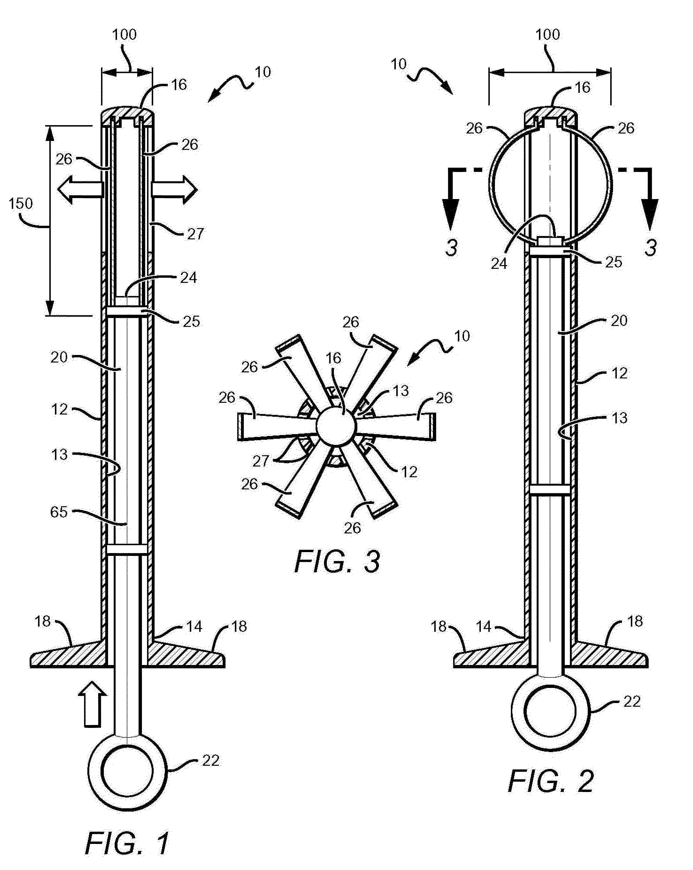 Betts osteotome