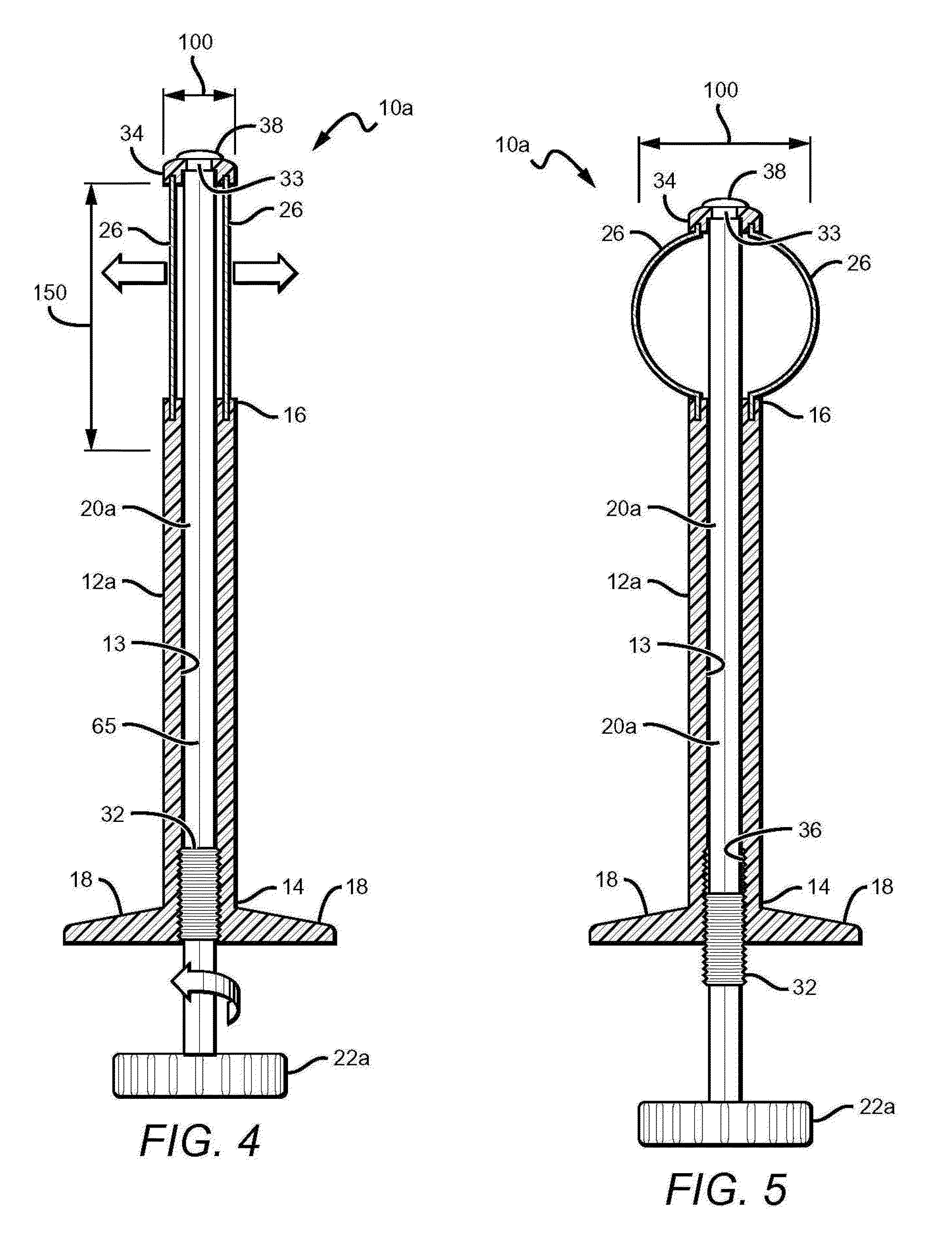 Betts osteotome