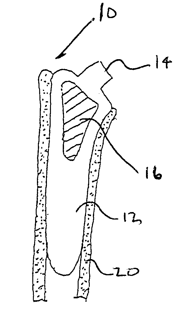 Arthroplasty and fixation devices with threaded intramedullary component