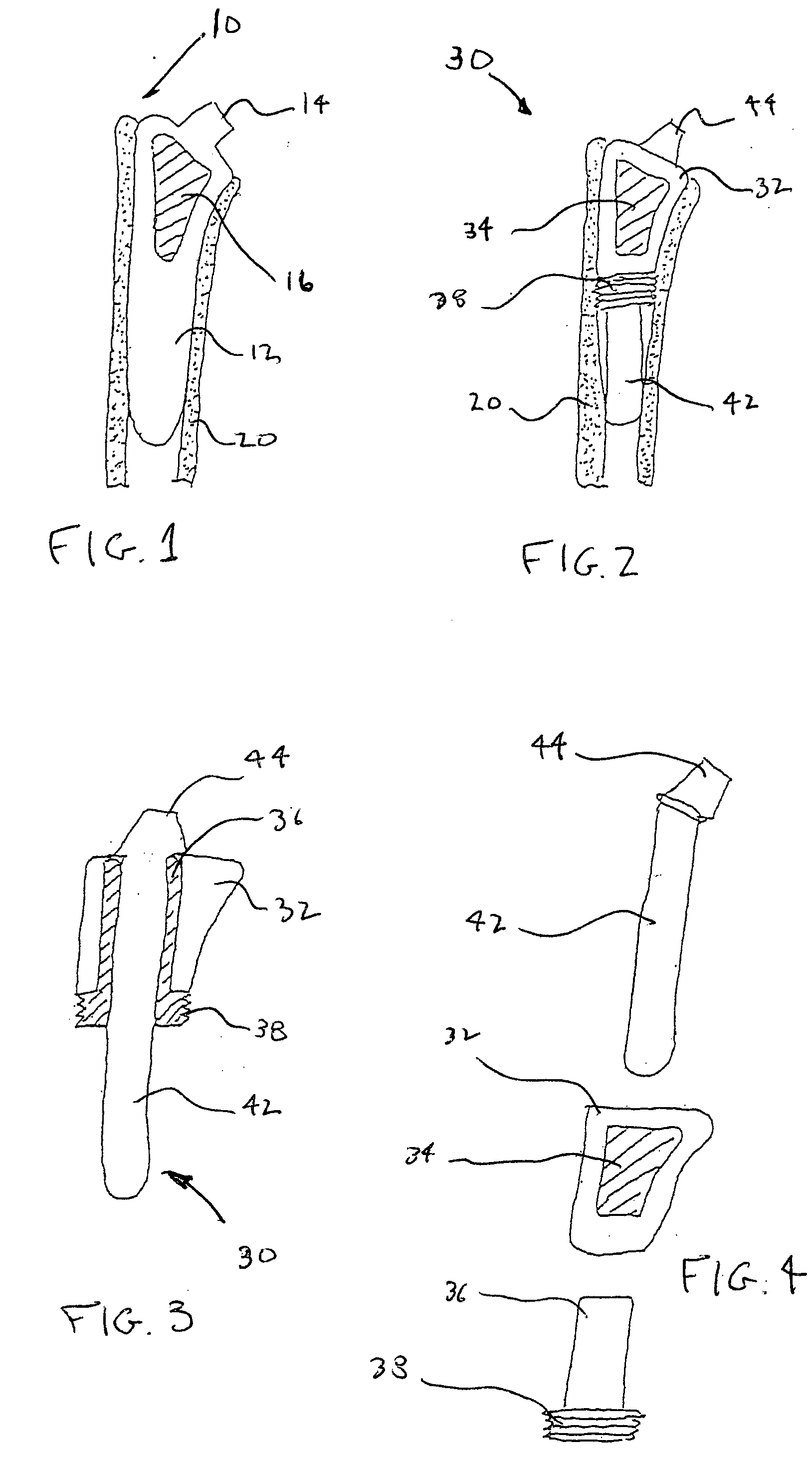 Arthroplasty and fixation devices with threaded intramedullary component