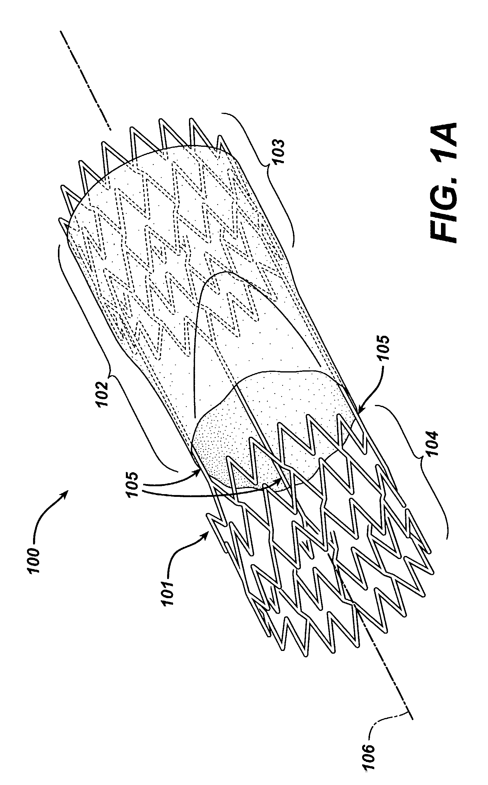 Frame based unidirectional flow prosthetic implant