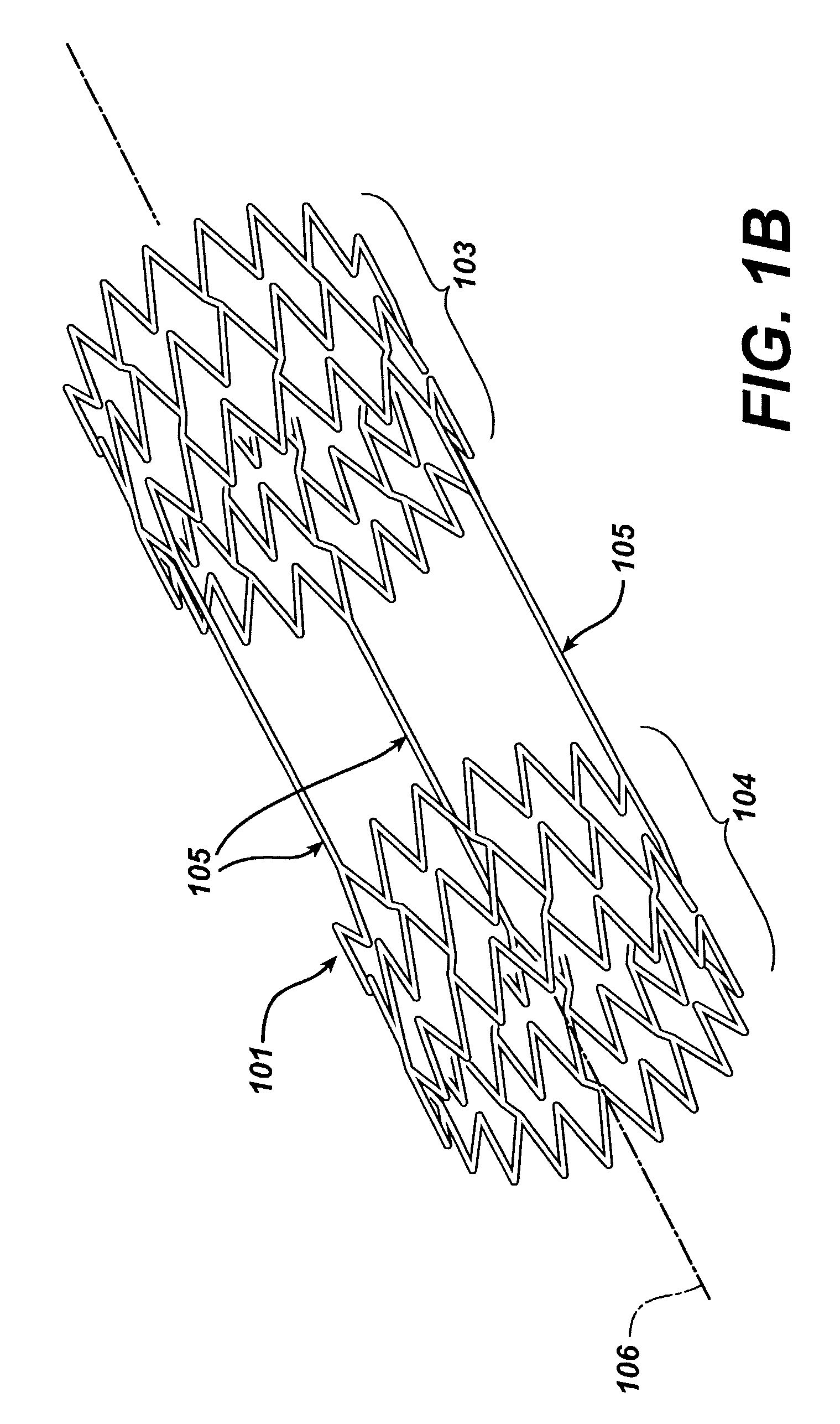 Frame based unidirectional flow prosthetic implant