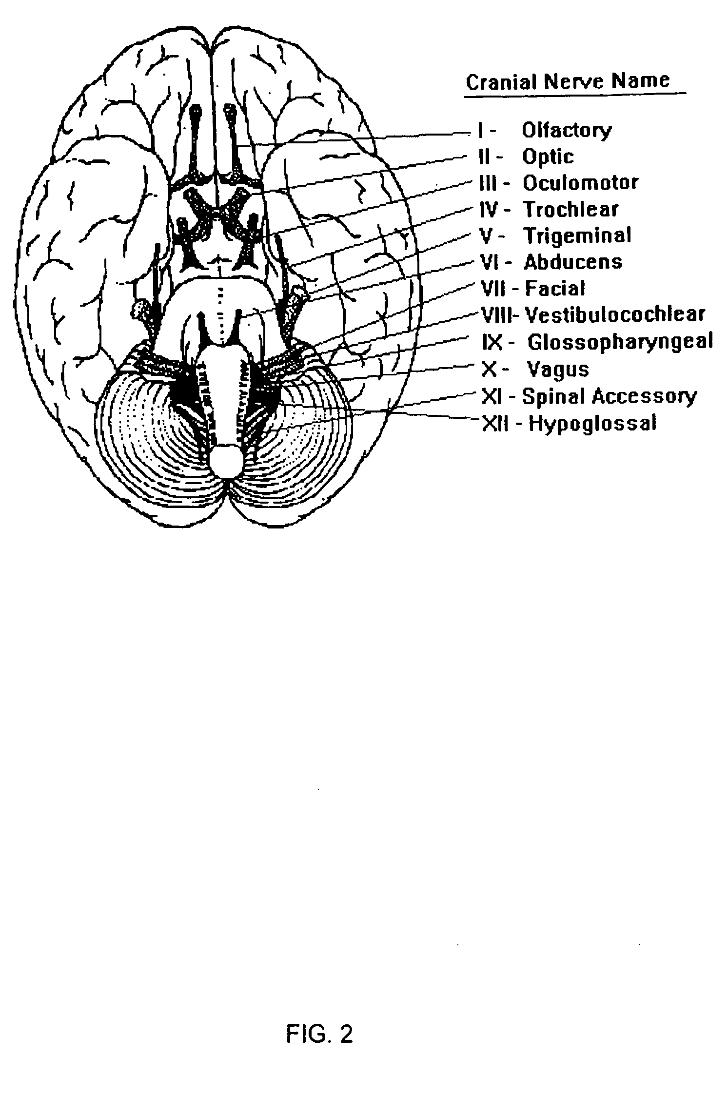 Method for treating hearing loss