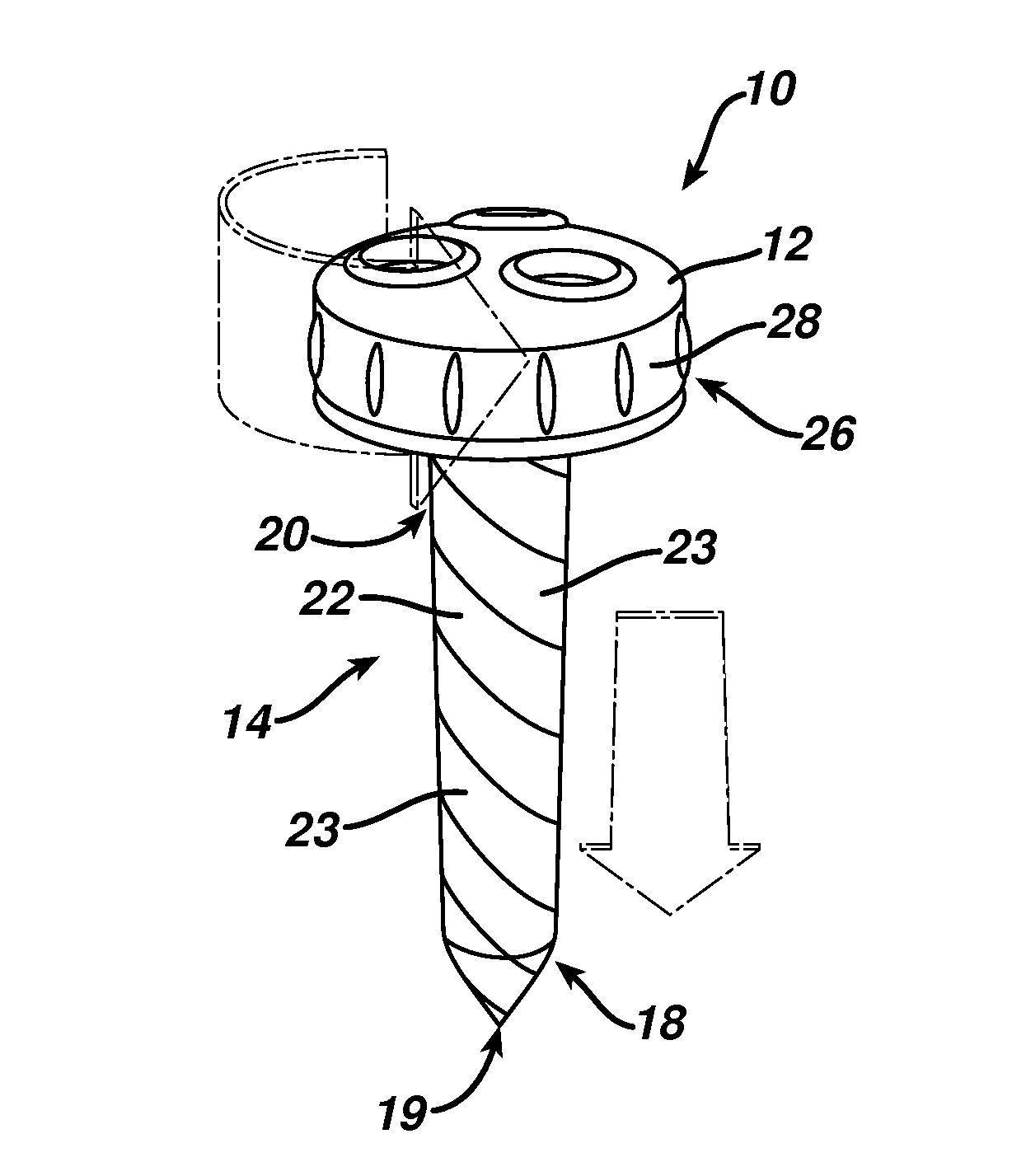 Methods and devices for providing access into a body cavity