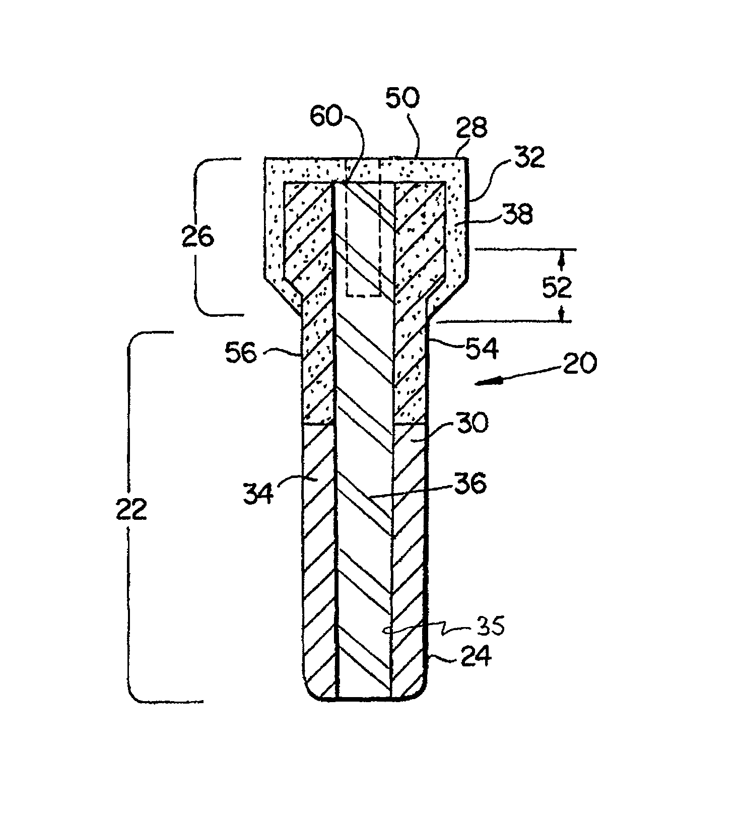 Dental implant prosthetic device with improved osseointegration and esthetic features