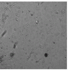 Preparation and regeneration method of pythium oligandrum protoplasts and composite enzymatic hydrolysate