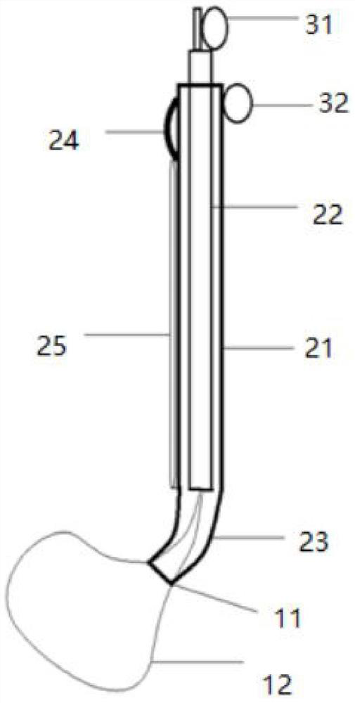 Specimen snare fixator for minimally invasive surgery