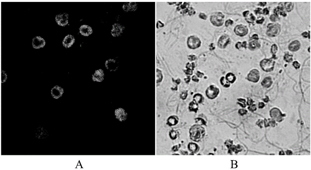 Antibody for detecting infectious spleen and kidney necrosis viruses as well as preparation and application thereof