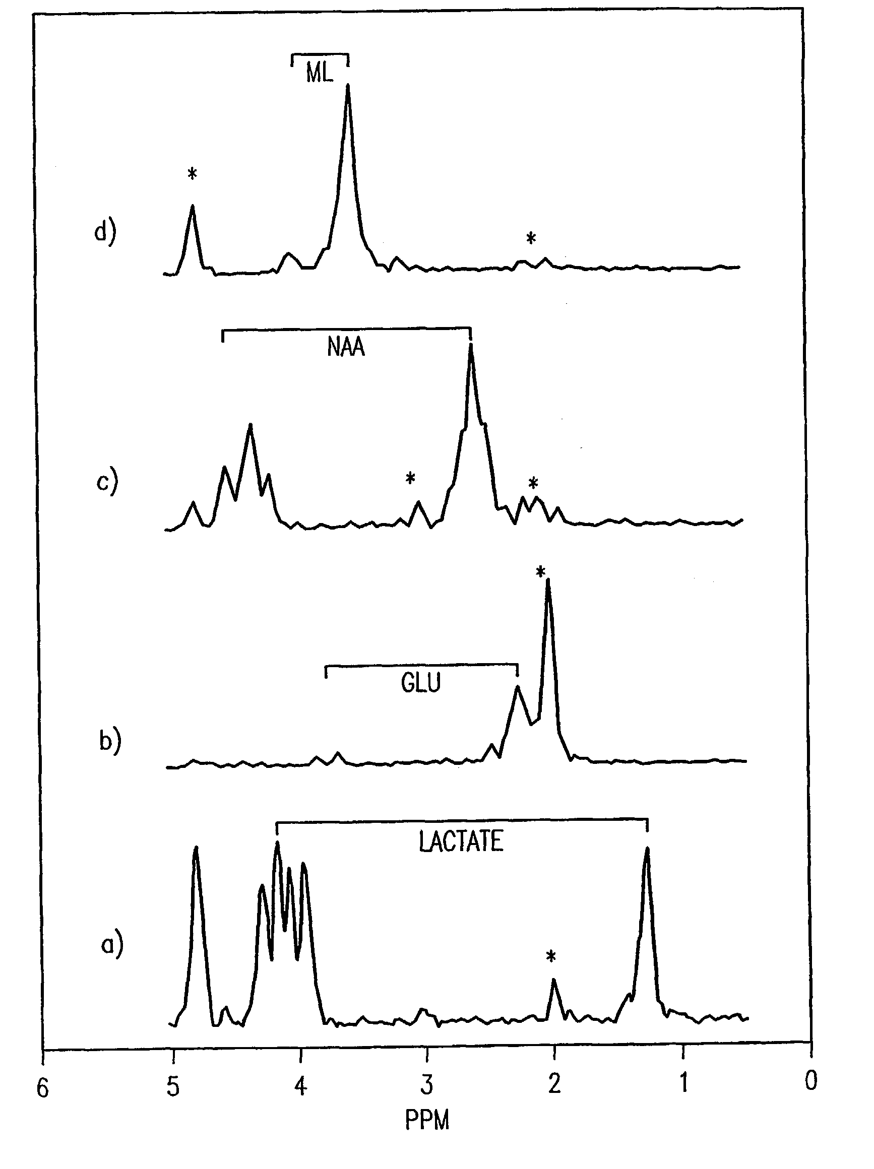 Localized two-dimensional shift correlated MR spectroscopy of human brain