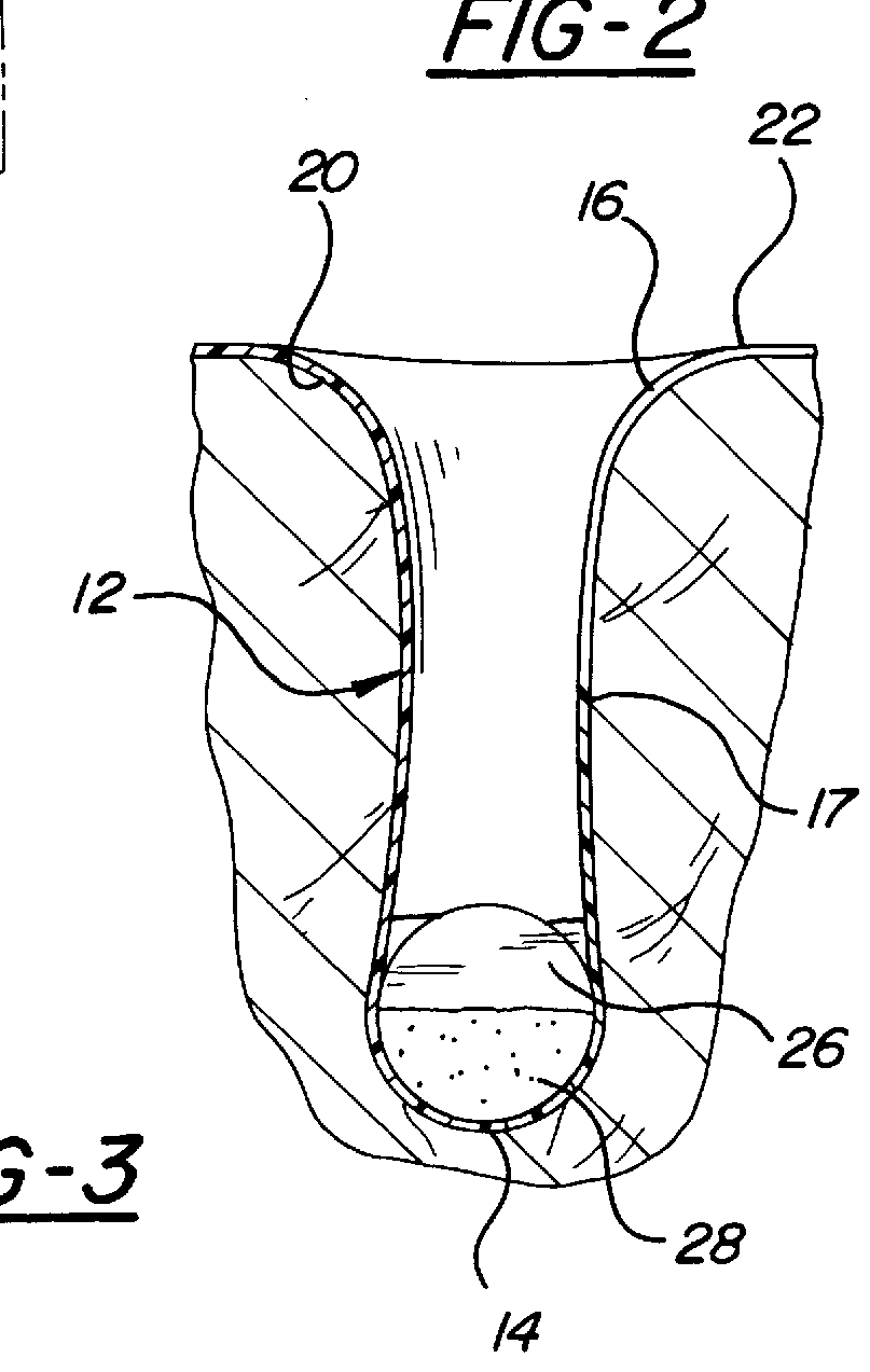 Female condom