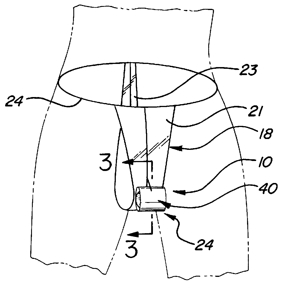 Female condom