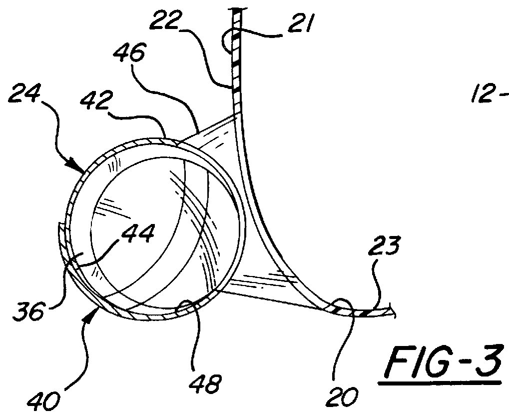 Female condom