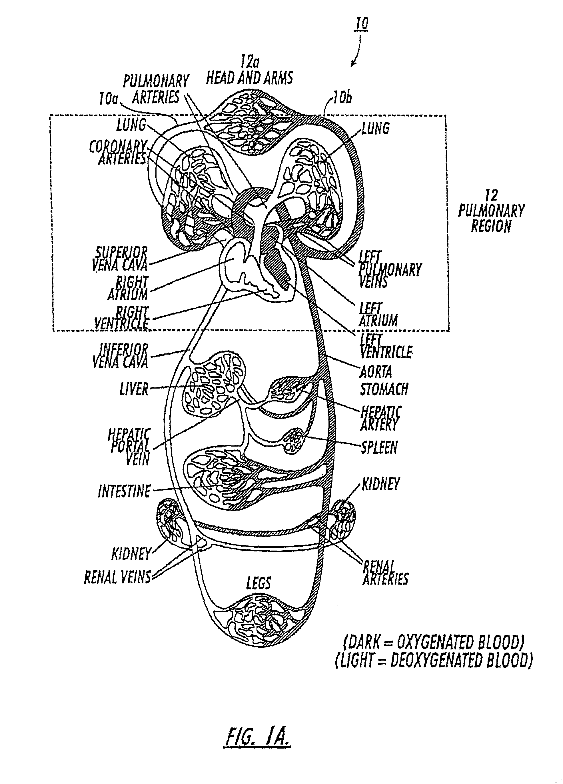 Diagnostic procedures using direct injection of gaseous hyperpolarized 129Xe and associated systems and products