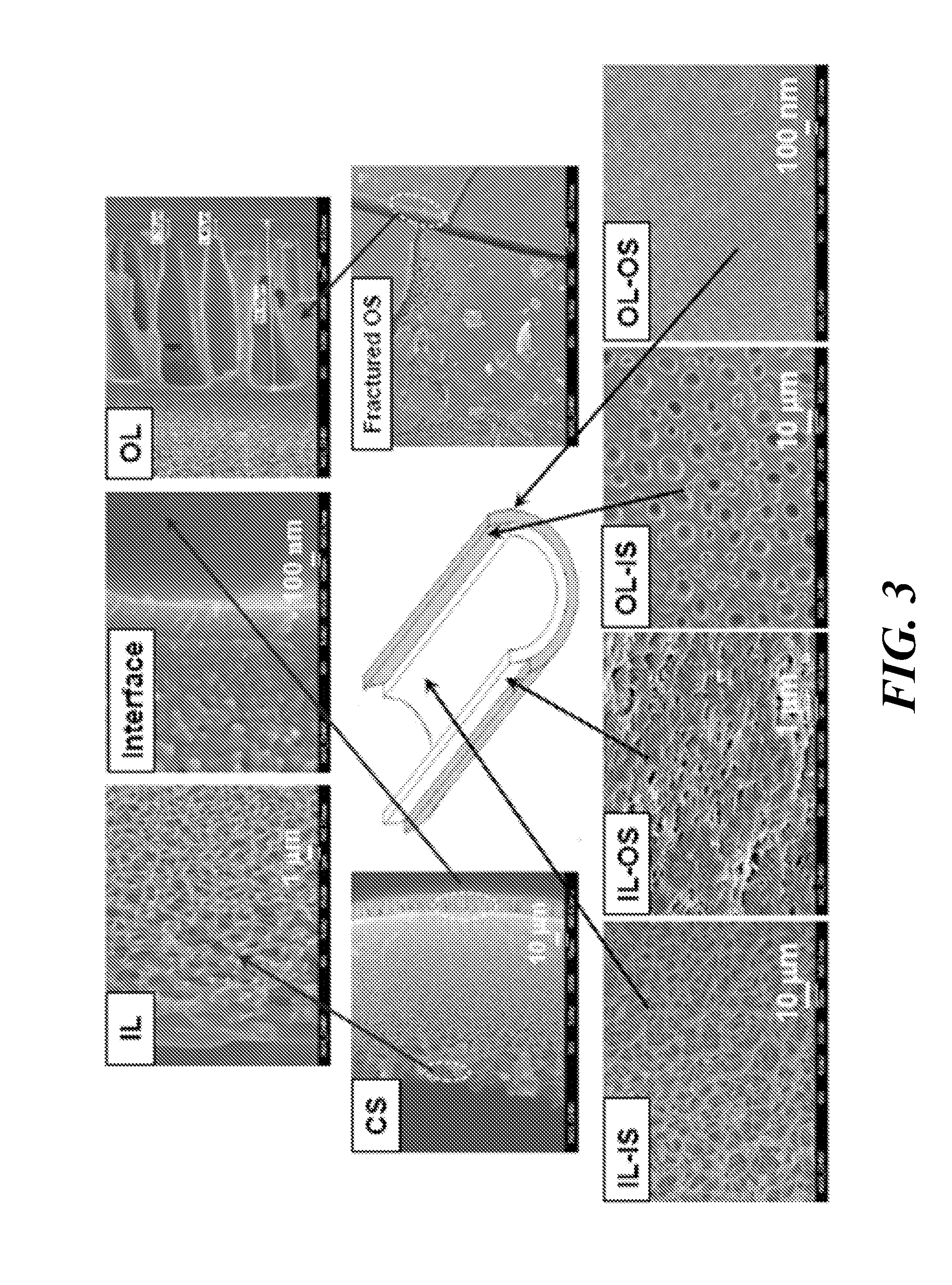 Dual-layer hollow fibers with enhanced flux as forward osmosis membranes for water reuses and protein enrichment