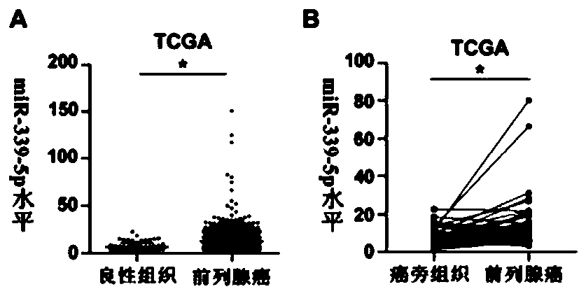 Application of mir-339-5p in inhibiting prostate cancer bone metastasis and TGF-β signaling pathway