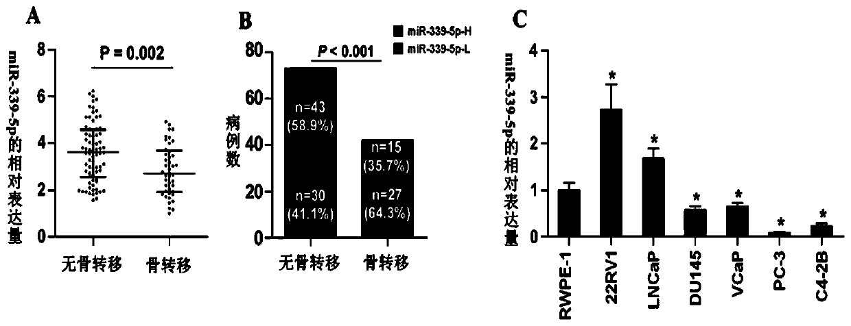 Application of mir-339-5p in inhibiting prostate cancer bone metastasis and TGF-β signaling pathway