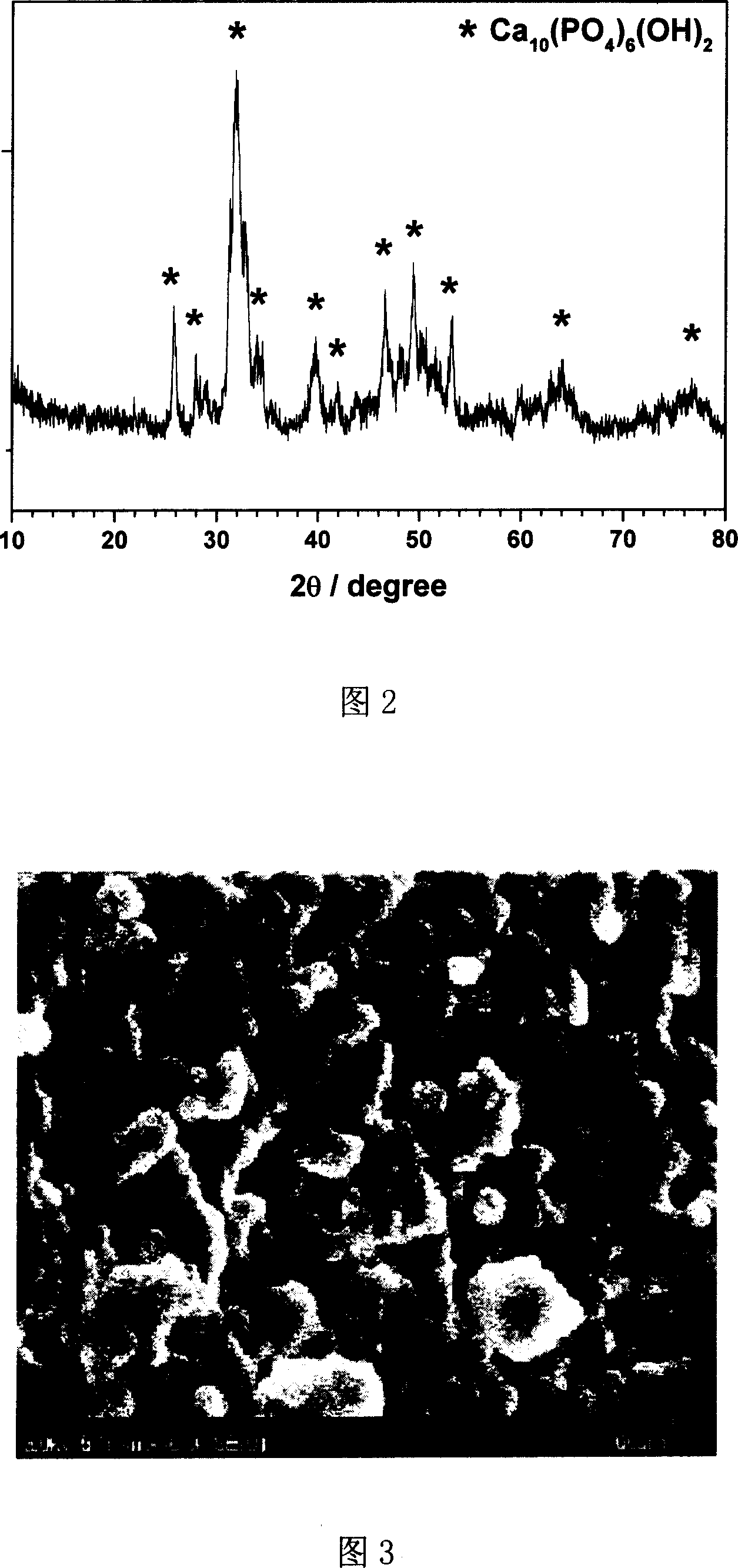 Method of preparing hydroxyapatite