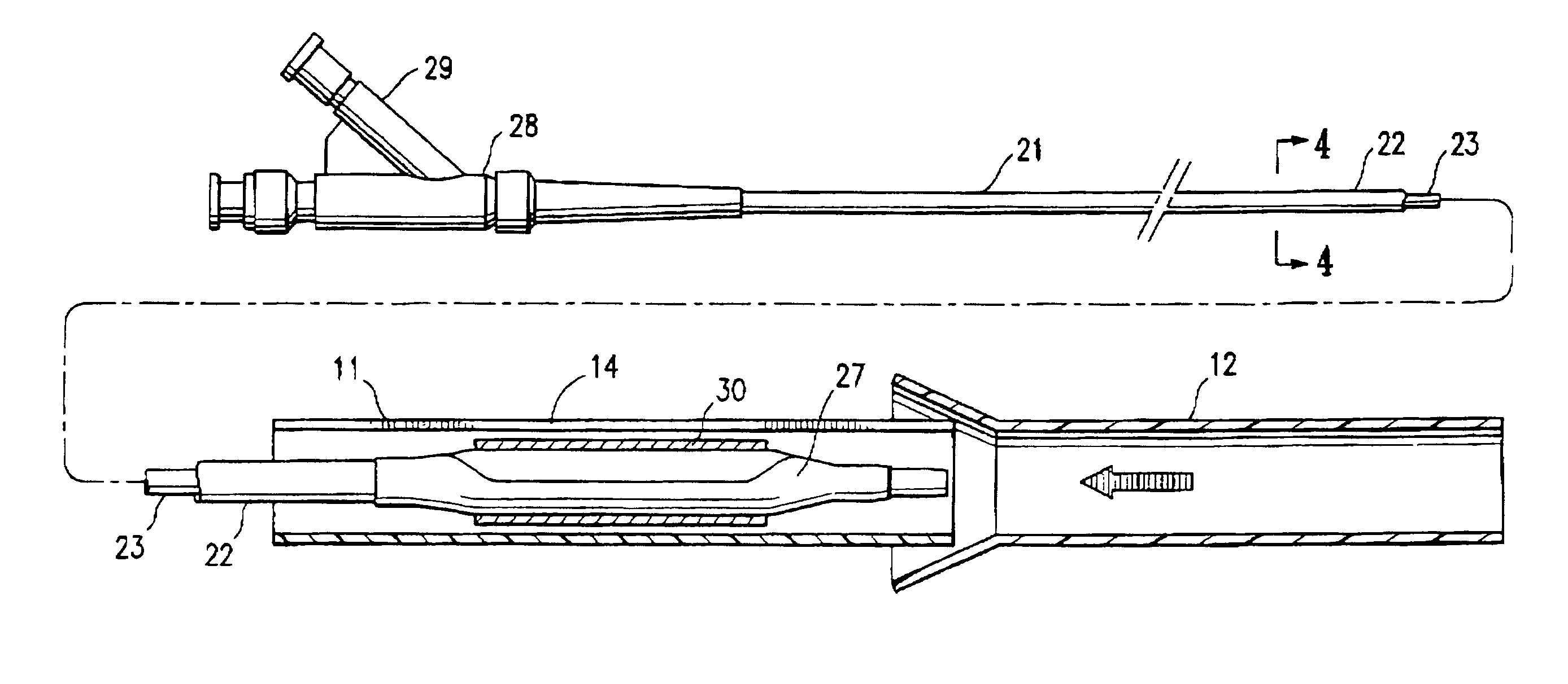 Protective sleeve assembly for a balloon catheter