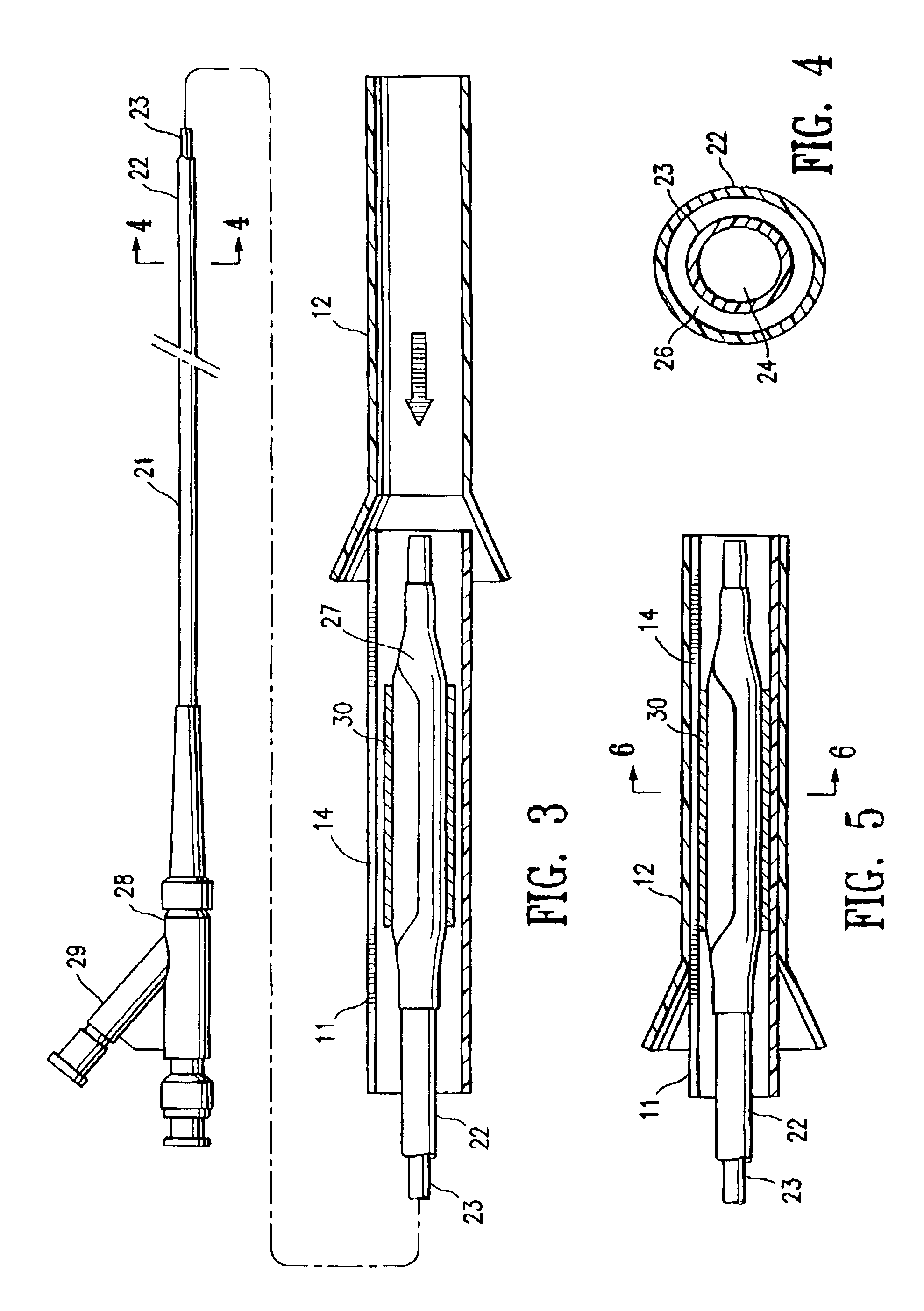 Protective sleeve assembly for a balloon catheter