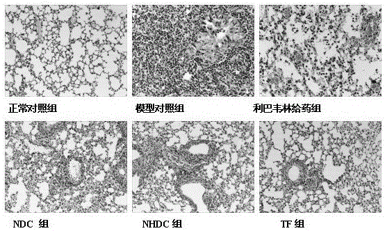 A kind of medicine for treating pulmonary infectious disease and application thereof