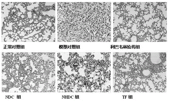 A kind of medicine for treating pulmonary infectious disease and application thereof