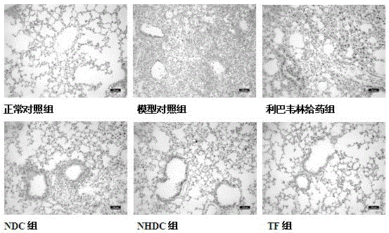 A kind of medicine for treating pulmonary infectious disease and application thereof