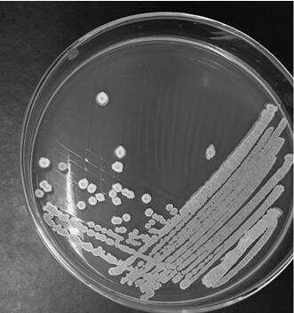 A strain of Bacillus siamese and its application in the control of plant powdery mildew