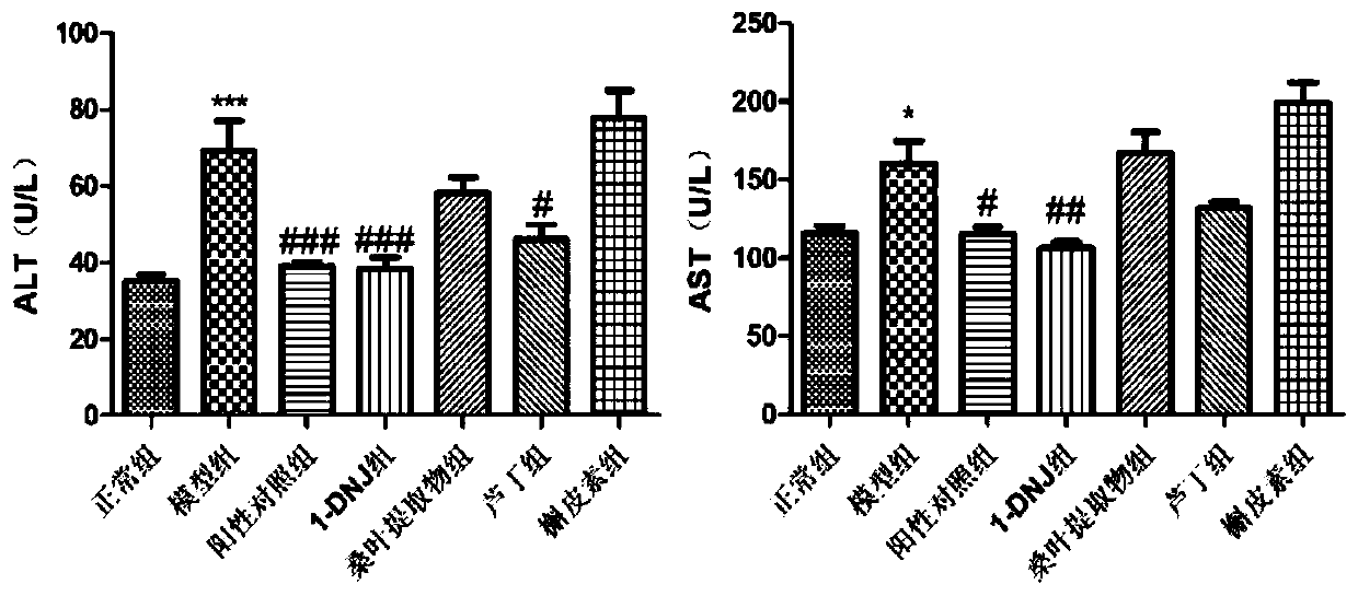 Application of 1-deoxynojirimycin in treatment of diabetic cardiomyopathy and liver injury